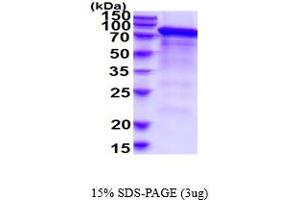 SDS-PAGE (SDS) image for Integrin beta 2 (ITGB2) (AA 23-700) protein (His tag) (ABIN5854581)