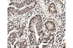IHC analysis of hnRNP D/AUF1/HNRNPD using anti-hnRNP D/AUF1/HNRNPD antibody (ABIN7602591). (HNRNPD/AUF1 anticorps  (AA 88-246))