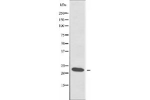 Western blot analysis of extracts from COLO cells using RPL18 antibody. (RPL18 anticorps)