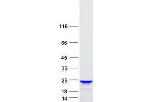 Validation with Western Blot