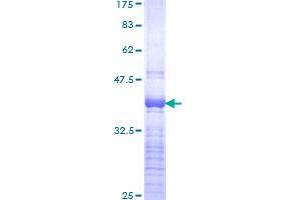 Image no. 1 for SRY (Sex Determining Region Y)-Box 4 (SOX4) (AA 45-136) protein (GST tag) (ABIN1321002)