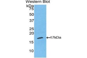 Western blot analysis of the recombinant protein. (TNFRSF19 anticorps  (AA 222-363))