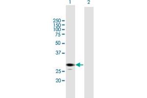 Western Blot analysis of ECHS1 expression in transfected 293T cell line by ECHS1 MaxPab polyclonal antibody. (ECHS1 anticorps  (AA 1-290))