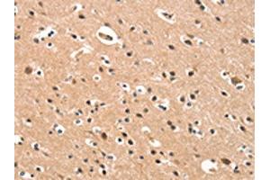 The image on the left is immunohistochemistry of paraffin-embedded Human brain tissue using ABIN7190422(CYP46A1 Antibody) at dilution 1/15, on the right is treated with synthetic peptide. (CYP46A1 anticorps)