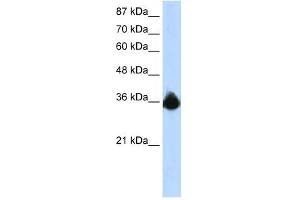 PTBP2 antibody used at 1. (PTBP2 anticorps  (N-Term))