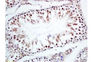 Formalin-fixed and paraffin embedded rat testies labeled with Rabbit Anti-CRNKL1 Polyclonal Antibody, Unconjugated (ABIN2173402) at 1:200 followed by conjugation to the secondary antibody and DAB staining (CRNKL1 anticorps  (AA 201-300))