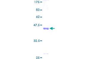 SDS-PAGE (SDS) image for Synuclein, beta (SNCB) (AA 1-134) protein (GST tag) (ABIN1320782)