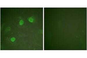 Immunofluorescence (IF) image for anti-GATA Binding Protein 3 (GATA3) (AA 274-323) antibody (ABIN2888838) (GATA3 anticorps  (AA 274-323))