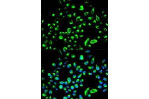 Immunofluorescence analysis of HeLa cell using YWHAQ antibody. (14-3-3 theta anticorps)