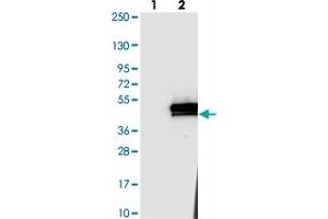 Western blot analysis of Lane 1: Negative control (vector only transfected HEK293T lysate). (ANKRD2 anticorps)