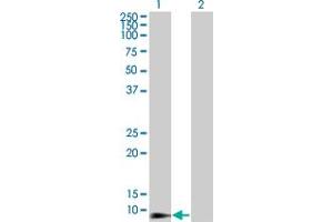 Western Blot analysis of DEFB4 expression in transfected 293T cell line by DEFB4 monoclonal antibody (M01), clone 4C4. (Defensin beta 4 anticorps  (AA 24-64))