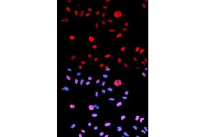 Immunofluorescence (IF) image for anti-Mdm2, p53 E3 Ubiquitin Protein Ligase Homolog (Mouse) (MDM2) (pSer166) antibody (ABIN1870422) (MDM2 anticorps  (pSer166))