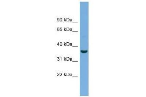 Crystallin Mu antibody used at 1 ug/ml to detect target protein. (CRYM anticorps  (N-Term))