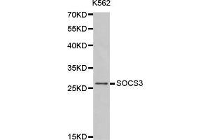 Western blot analysis of extracts of K562 cells tissue, using SOCS3 antibody. (SOCS3 anticorps  (C-Term))