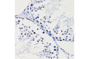 Immunohistochemistry of paraffin-embedded Rat testis using HD antibody (ABIN7267707) at dilution of 1:100 (40x lens).