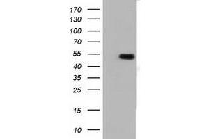 Western Blotting (WB) image for anti-Tubulin, alpha 3e (TUBA3E) antibody (ABIN1501557) (TUBA3E anticorps)