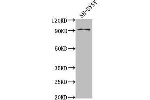 Western Blot Positive WB detected in: SH-SY5Y whole cell lysate All lanes: GPLD1 antibody at 1:2000 Secondary Goat polyclonal to rabbit IgG at 1/50000 dilution Predicted band size: 93, 20 kDa Observed band size: 93 kDa (GPLD1 anticorps  (AA 310-565))