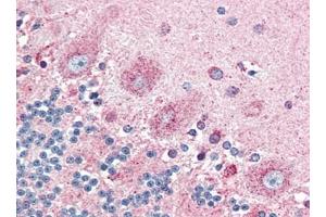 Human Brain, Cerebellum (formalin-fixed, paraffin-embedded) stained with GPR44at 5 µg/ml followed by biotinylated goat anti-rabbit IgG secondary antibody, alkaline phosphatase-streptavidin and chromogen.