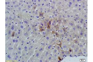 Formalin-fixed and paraffin embedded mouse liver labeled with Rabbit Anti phospho-GCN2 (Thr667) Polyclonal Antibody, Unconjugated (ABIN684958) at 1:200 followed by conjugation to the secondary antibody and DAB staining (GCN2 anticorps  (pThr667))