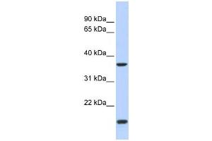 Western Blotting (WB) image for anti-Zic Family Member 4 (ZIC4) antibody (ABIN2458430) (ZIC4 anticorps)