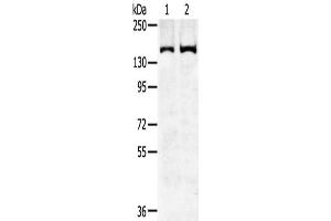 Gel: 6 % SDS-PAGE,Lysate: 40 μg,Lane 1-2: Hela cells, K562 cells,Primary antibody: ABIN7192310(SENP6 Antibody) at dilution 1/450 dilution,Secondary antibody: Goat anti rabbit IgG at 1/8000 dilution,Exposure time: 5 minutes (SENP6 anticorps)
