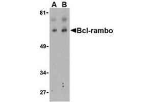 Western blot analysis of Bcl-rambo in K562 cell lysate with AP30131PU-N Bcl-rambo antibody at (A) 2 and (B) 4 μg/ml. (BCL2L13 anticorps  (Intermediate Domain))