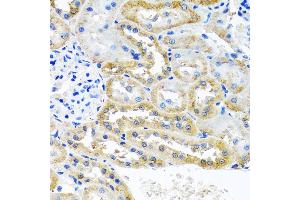 Immunohistochemistry of paraffin-embedded rat kidney using OGFR antibody (ABIN6128395, ABIN6145006, ABIN6145007 and ABIN6222871) at dilution of 1:100 (40x lens).