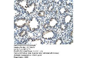 Rabbit Anti-RAD23A Antibody  Paraffin Embedded Tissue: Human Lung Cellular Data: Alveolar cells Antibody Concentration: 4. (RAD23A anticorps  (N-Term))