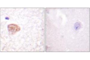 Immunohistochemistry (IHC) image for anti-DEAD (Asp-Glu-Ala-Asp) Box Polypeptide 3, X-Linked (DDX3X) (AA 466-515) antibody (ABIN2888820) (DDX3X anticorps  (AA 466-515))