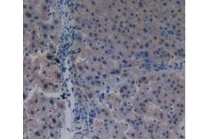 Detection of PAK1 in Human Liver Tissue using Polyclonal Antibody to p21 Protein Activated Kinase 1 (PAK1)