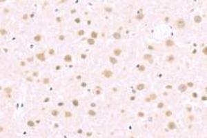 Immunohistochemistry analysis of paraffin-embedded rat cerebral infarction using BAAT1 (ABIN7073502) at dilution of 1: 1000 (BAAT1 anticorps)