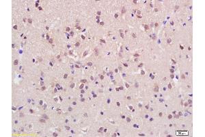 Formalin-fixed and paraffin embedded rat brain labeled with Rabbit Anti KMT2H/ASH1L Polyclonal Antibody, Unconjugated (ABIN1387873) at 1:200 followed by conjugation to the secondary antibody and DAB staining (ASH1L anticorps  (AA 1985-2060))