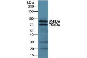 Western blot analysis of Human U937 Cells. (Integrin beta 2 anticorps  (AA 451-627))