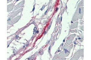 DDAH2 antibody was used for immunohistochemistry at a concentration of 4-8 ug/ml.