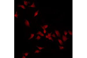 ABIN6275099 staining HT29 by IF/ICC.