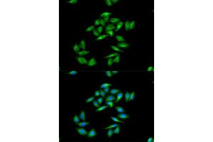 Immunofluorescence analysis of A-549 cells using CPT1A antibody. (CPT1A anticorps  (AA 497-756))
