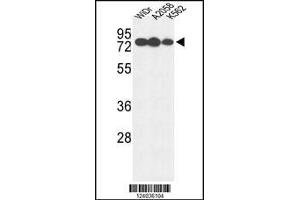 Western blot analysis of GUSB Antibody in WiDr, A2058, K562 cell line lysates (35ug/lane) (Glucuronidase beta anticorps  (AA 335-362))