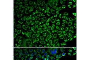 Immunofluorescence analysis of A549 cells using F10 Polyclonal Antibody (Coagulation Factor X anticorps)