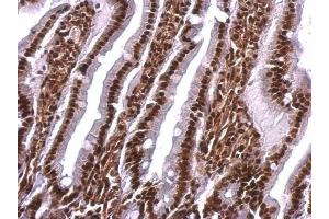 IHC-P Image Scaffold attachment factor B1 antibody detects Scaffold attachment factor B1 protein at nucleus on rat fore brain by immunohistochemical analysis.