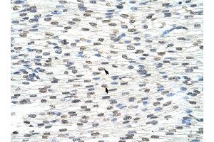 THOC3 antibody was used for immunohistochemistry at a concentration of 4-8 ug/ml to stain Myocardial cells (arrows) in Human Heart.