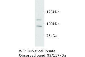 Image no. 1 for anti-Mast/stem Cell Growth Factor Receptor (KIT) antibody (ABIN1112872) (KIT anticorps)