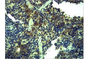 Immunohistochemistry (IHC) image for anti-Toll-Like Receptor 1 (TLR1) antibody (ABIN3181539) (TLR1 anticorps)