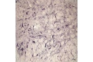 IHC on rat spinal cord using Rabbit antibody to extracellular, N-terminal part of Sortilin (Neurotensin receptor 3, NTR3, Sort1): IgG  at a concentration of 10 µg/ml. (Sortilin 1 anticorps)