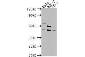 Western Blot Positive WB detected in: Hela whole cell lysate, MCF-7 whole cell lysate, PC-3 whole cell lysate All lanes: POU4F1 antibody at 1:2000 Secondary Goat polyclonal to rabbit IgG at 1/50000 dilution Predicted band size: 43, 34 kDa Observed band size: 43 kDa (POU4F1 anticorps  (AA 258-419))