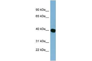WB Suggested Anti-C14orf148 Antibody Titration: 0. (NOXRED1 anticorps  (Middle Region))
