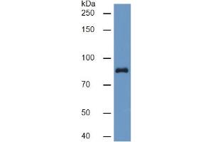 Rabbit Capture antibody from the kit in WB with Positive Control: Sample Human Serum. (PLG Kit ELISA)