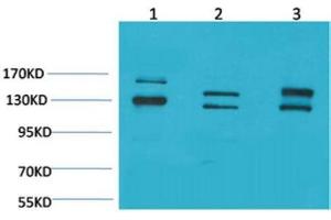 Western Blot (WB) analysis of 1) 293T, 2) Mouse Brain Tissue, 3) Rat Brain Tissue with BAI1 Rabbit Polyclonal Antibody diluted at 1:2000.