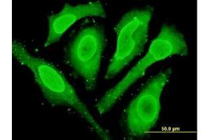 Image no. 2 for anti-Cytoglobin (CYGB) (AA 1-191) antibody (ABIN466266) (CYGB anticorps  (AA 1-191))
