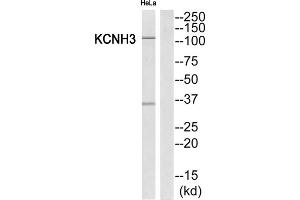 Western Blotting (WB) image for anti-Potassium Voltage-Gated Channel, Subfamily H (Eag-Related), Member 3 (Kcnh3) (Internal Region) antibody (ABIN1851848)