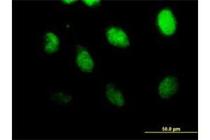 Immunofluorescence of purified MaxPab antibody to CSPG6 on HeLa cell. (SMC3 anticorps  (AA 1-1217))